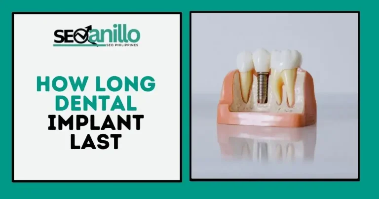How Long Dental Implant Last